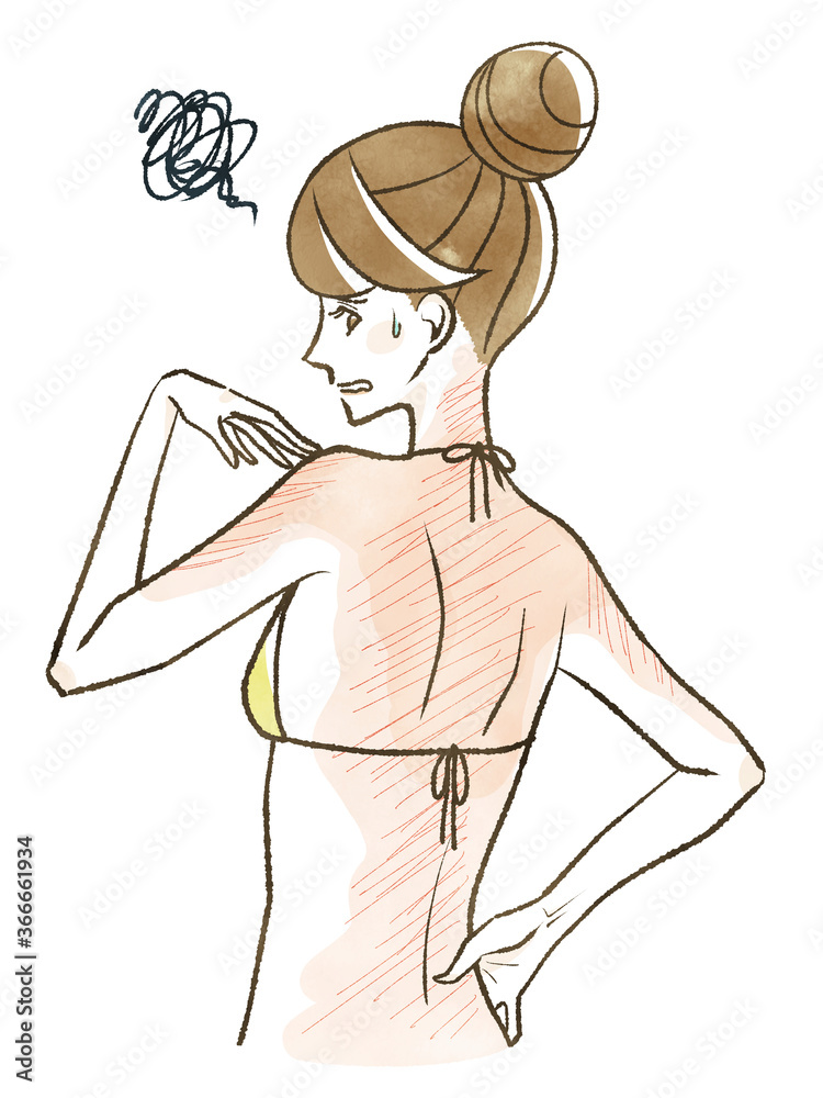 Fototapeta premium 背中の日焼けに悩んでいる女性