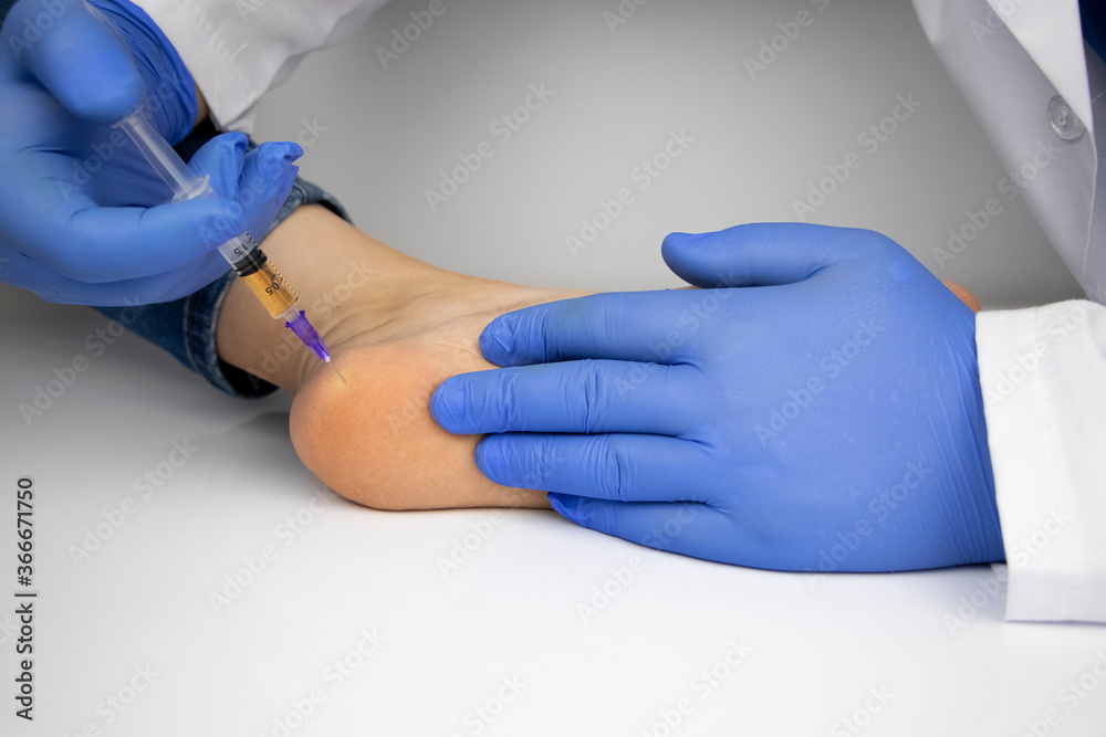 An orthopedic surgeon gives an injection in the heel to relieve pain from a heel spur. The concept of medical care and non-surgical treatments.