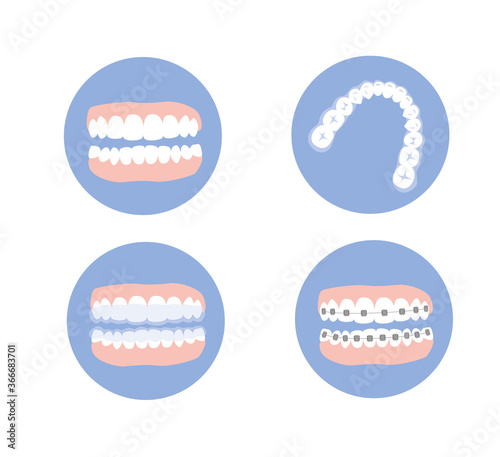Orthodontic set of jaws with teeth while treatment. Brace and retainer on teeth. Flat vector illustration.