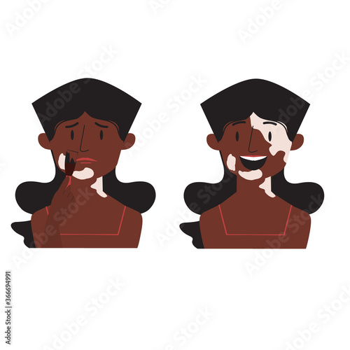 Vitiligo. African woman with pigmentation on skin isolated on a white background. Joyful and sad face vector flat illustration.