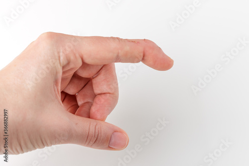 Fotografija cut index finger with a extensor tendon injury, mallet finger wound, tip of the