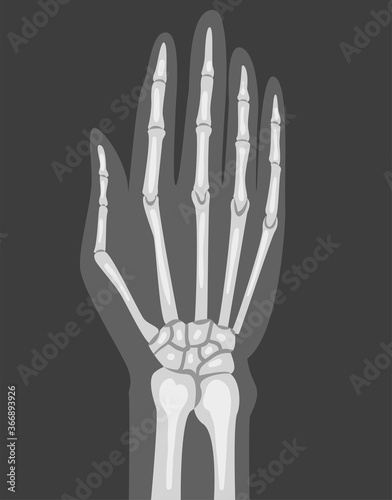 X-ray Film of Hand Vector Illustrated Image for Educational Purpose