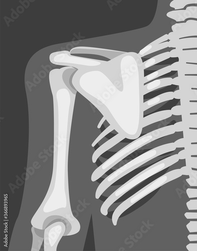 X-ray Film of Chest Vector Illustrated Image for Educational Purpose