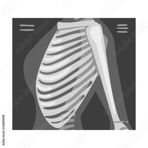 X-ray Film of Ribs Vector Illustrated Image for Educational Purpose