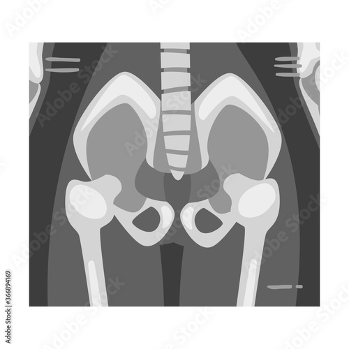 X-ray Film of Coxofemoral Joint Front View Vector Illustrated Image for Educational Purpose