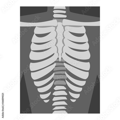 Roentgenograph of Spine and Back Bone Vector Image photo