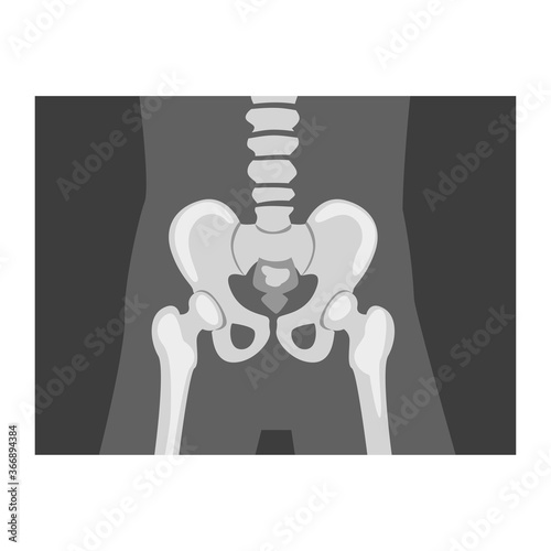 Roentgenograph of Coxofemoral Joint Front View Vector Image