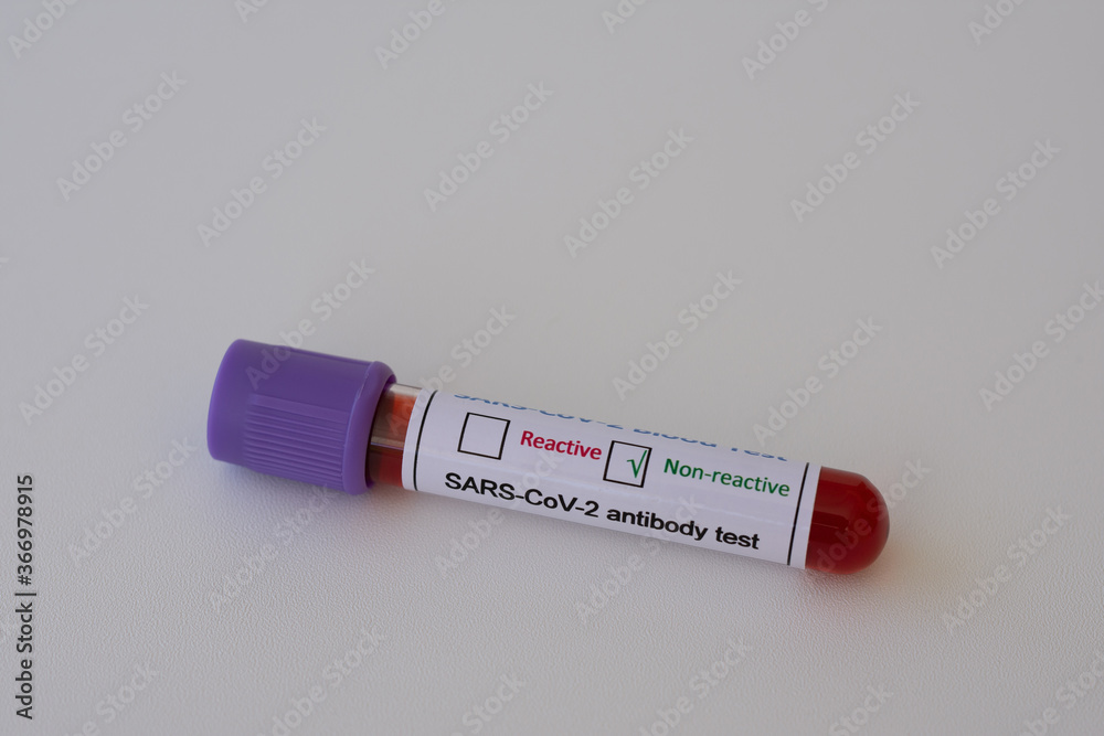 Non-reactive result, test for antibodies to Coronavirus COVID-19 or SARS-CoV-2 infection. Serology blood test concept. Non-reactive result, test for antibodies to Coronavirus COVID-19 or SARS-CoV-2 infection. Serology blood test concept.