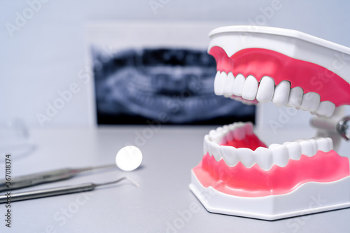 Educational teeth model and dentist mirror instrument. X-ray in the background.