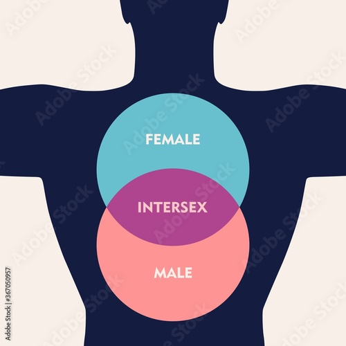 Transgender transsexual concept. Unconventional sexual orientation illustration.