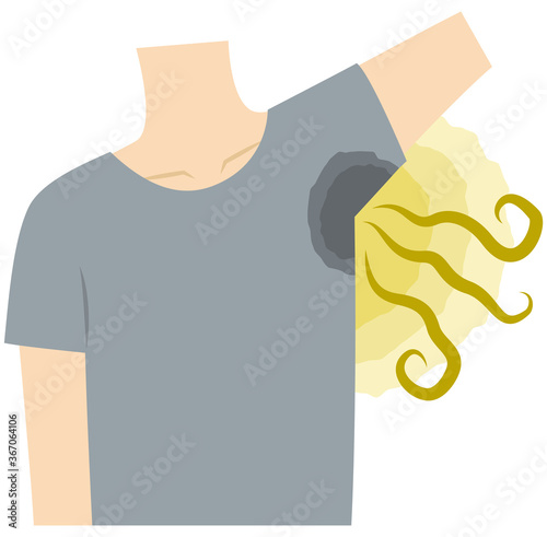 脇の汗染み・脇の臭い・体臭に悩む男性／多汗症／腋臭症