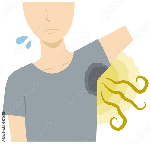 脇の汗染み・脇の臭い・体臭に悩む男性／多汗症／腋臭症