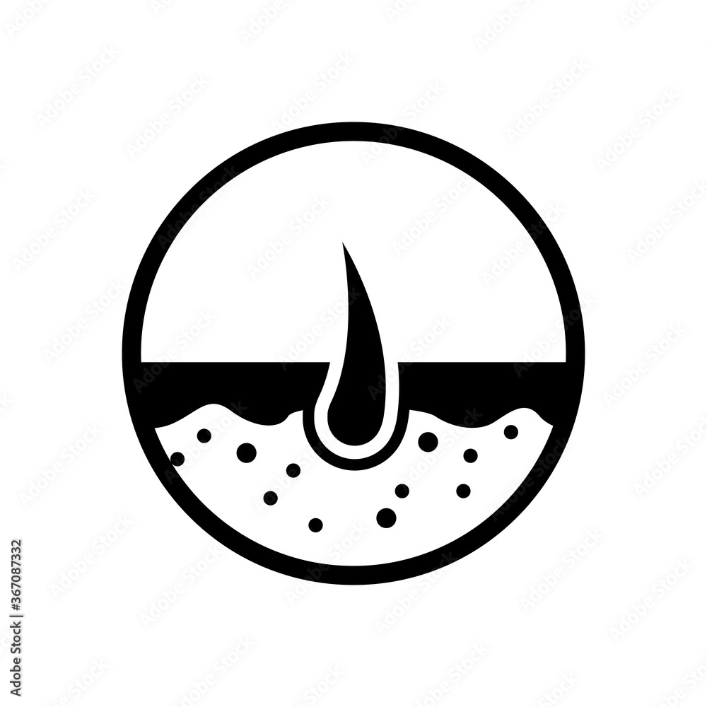 Hair loses illustration. Design template vector Hair loses illustration. Design template vector