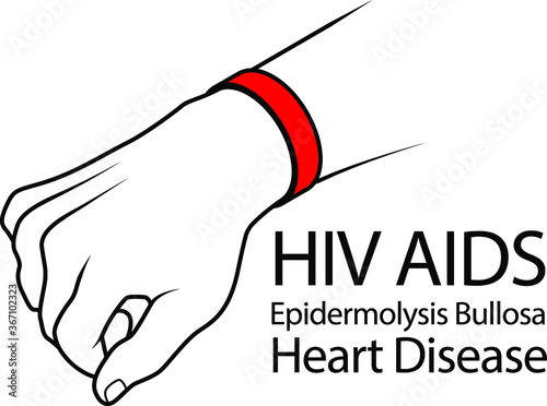 A hand with a cause bracelet. Red, HIV AIDS, Epidermolysis Bullosa, Heart Disease.
