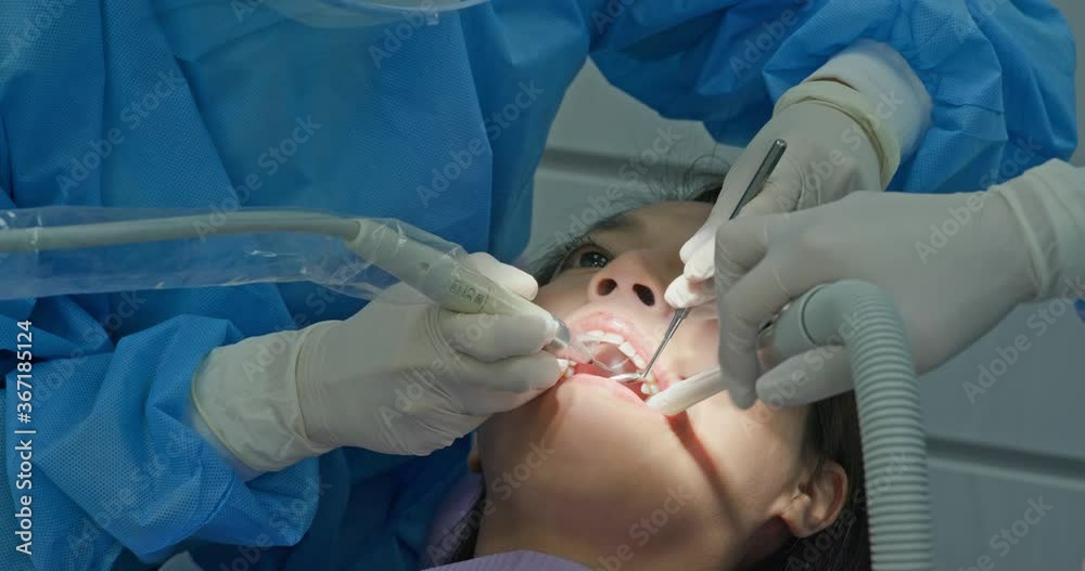 Woman undergo dental scaling treatment Woman undergo dental scaling treatment