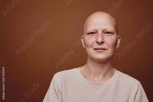 Minimal head and shoulders portrait of bald woman smiling at camera while posing against warm toned background in studio, alopecia and cancer awareness, copy space