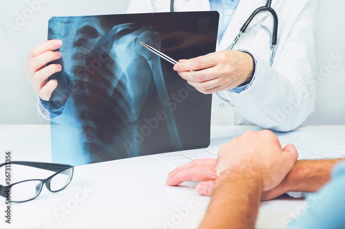 Female doctors hand pointing at x-ray medical imaging with a shoulder condition. Bone health, impingement. Orthopedics medicine. Healthcare and medicine. Injury. SLAP lesion. Patient visiting doctor photo