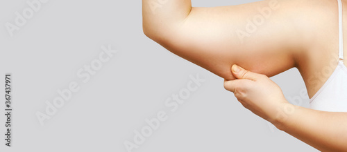 Cuadro en lienzo Young woman pinch fat arm