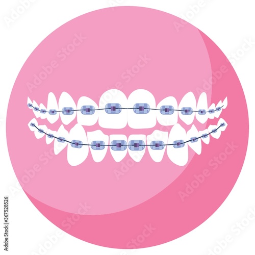 dental braces