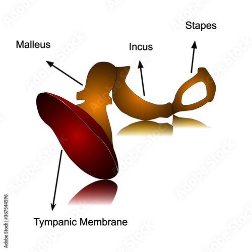 Illustration of tympanic membrane with bony ossicles within inner ear.