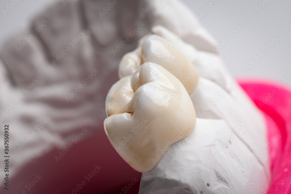 Dental Art, Smile design, Teeht Dental Art, Smile design, Teeht