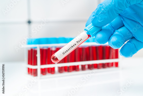Blood sample   test tube in doctor hand for  Gonorrhea