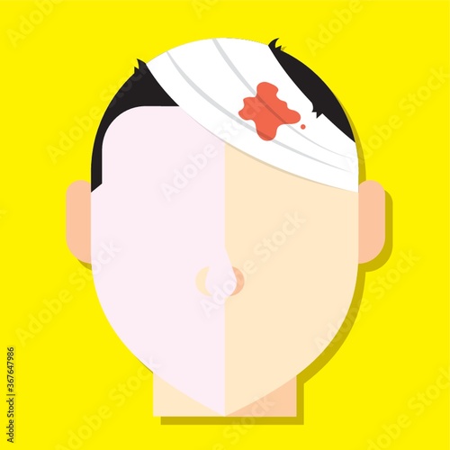 wound on head
