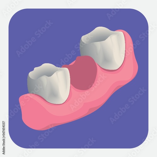extracted tooth