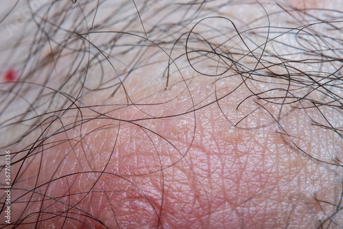 Part of the skin of a man with hair near the areola of the nipple with a strong increase. Concept - human skin and care for it.