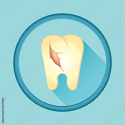 cracked tooth