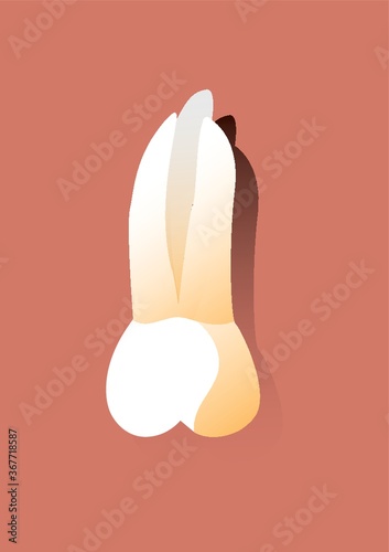 molar tooth