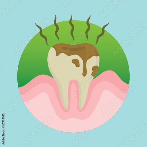 tooth with cavity