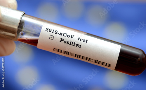 Stock photo of holding tube with Blood Test(novel Coronavirus 2019 disease,COVID-19,nCoV) and flag of EU. Europe virus outbreak.