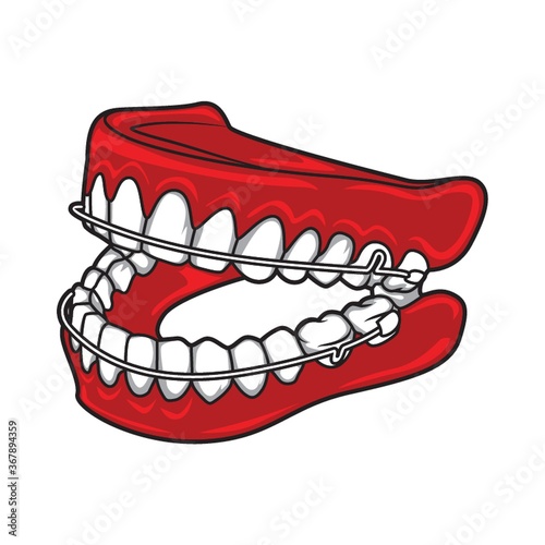 teeth set