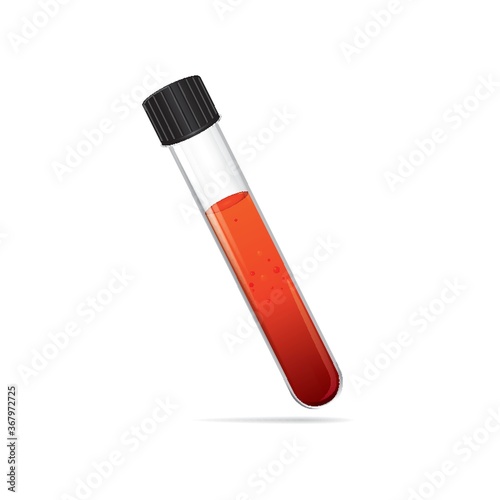 blood sample