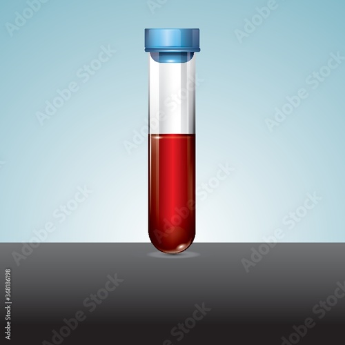 blood and plasma in test tube