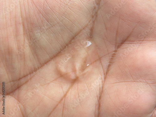 Transparent dollop of Hand sanitizer liquid on palm of hand