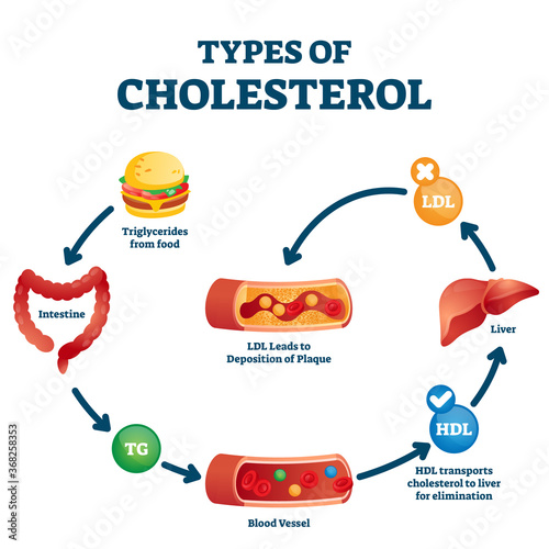 Types of cholesterol educational cycle scheme from fatty food to LDL artery