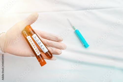 Handwriting text writing Interface. Conceptual photo the means by which interaction or communication is achieved Extracted blood sample vial ready for medical diagnostic examination photo