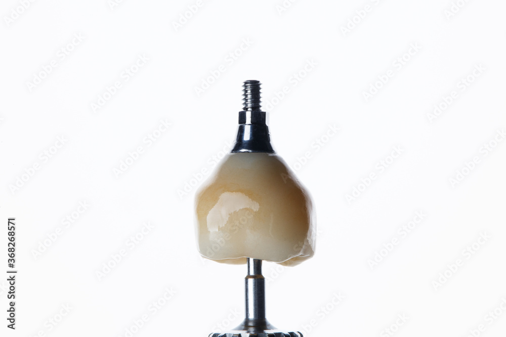 macro photo of dental crown on a white background with an orthopedic screwdriver macro photo of dental crown on a white background with an orthopedic screwdriver