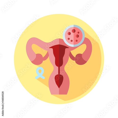 Cervical Cancer Info Graphic Element Flat Icon Illustration