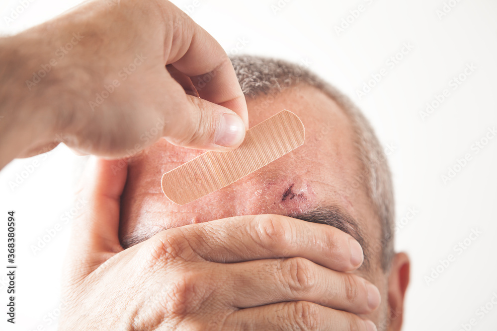 Fototapeta premium Hand showing adhesive bandage on man wound.
