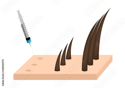 Platelet-Rich plasma . prp . hair growth vector