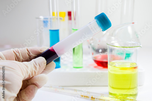 Blood test tube sample without name, empty space for text, laboratory background