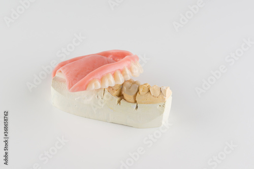 image of a modern denture nylone photo