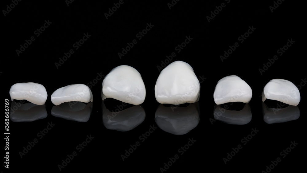 ceramic dental veneers, for the lower jaw of central incisors, filmed on black glass with reflection