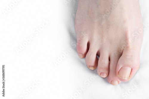 Obraz na płótnie Toenails on a woman's feet
