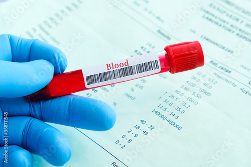 Complete blood samples and blood test results . Health and medical concepts