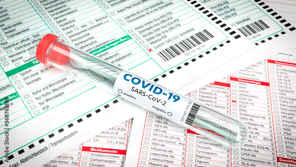 Covid-19  Abstrich-Teströhrchen auf medizinischen Testformularen