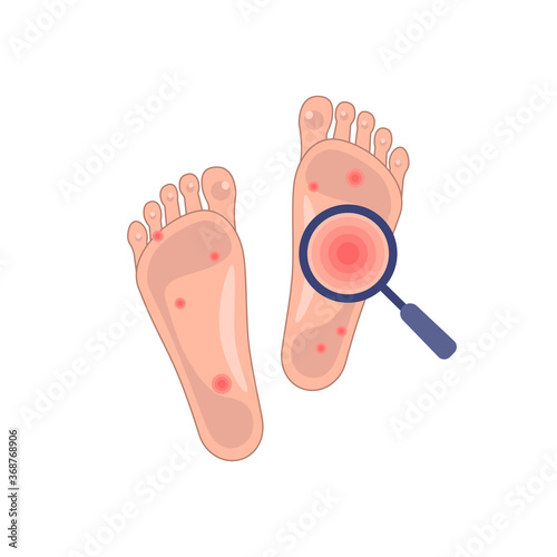 problem skin of feet icon